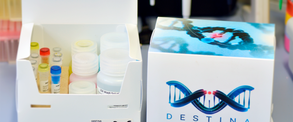 Dos kits de análisis de daño hepático producidos por Destina Genomics. En uno de ellos, cuya caja está abierta, pueden verse los diferentes reactivos.